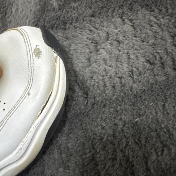 Adidas Strutter Ayakkabısının Kısa Sürede Açılma Ve Soyulma Sorunu İade Reddedildi