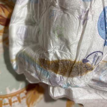 Molfix Bebek Bezinde Sızdırma Ve Kahverengi Leke, 40 Gün Cevapsız Şikayet