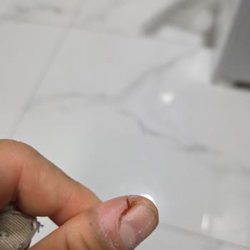 Aksigorta'dan Duşakabin Patlaması Sonrası Tam Yenileme Talebi