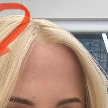 Akın Akça Hair Atelier Yaşadığım Saç Kopması Ve Sonrasındaki Süreç