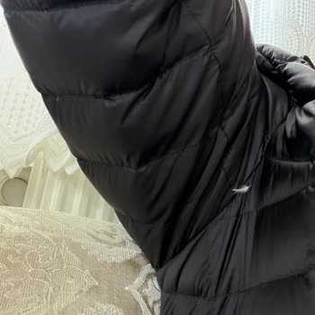 Lufian Montunda Aşırı Tüylenme Ve İletişim Eksikliği