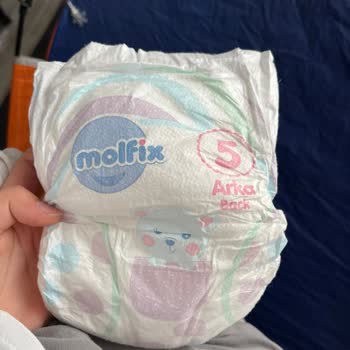 Molfix Bebek Bezinde Yabancı Madde Ve Şirketin Cevapsızlığı