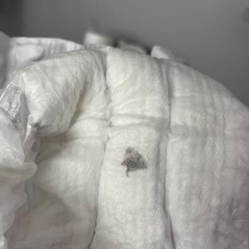 Molfix Bebek Bezinde Yabancı Madde Ve Şirketin Cevapsızlığı