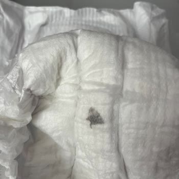 Molfix Bebek Bezinde Yabancı Madde Ve Şirketin Cevapsızlığı