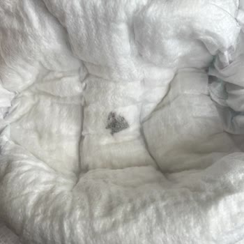Molfix Bebek Bezinde Yabancı Madde Ve Şirketin Cevapsızlığı