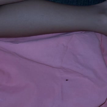 Tree Home Bungalov’da Tahta Kurusu Sorunu Ve Tam Ücret İadesi Talebi