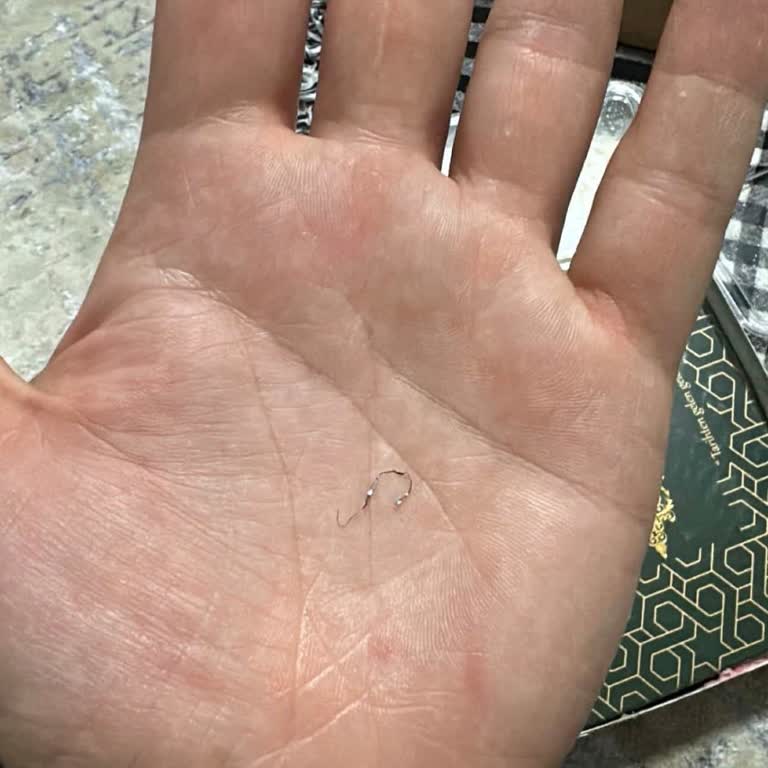 Kazandibi İçinde Metal Tel: Sağlık Tehlikesi Ve Cevapsız Yanıt