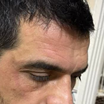 Sebamed Şampuanı Alerjik Reaksiyon Ve Gratis Mağaza Çalışanının Değişim Reddine Şikayet