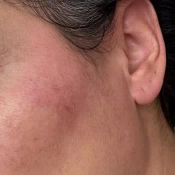 Sebamed Şampuanı Alerjik Reaksiyon Ve Gratis Mağaza Çalışanının Değişim Reddine Şikayet