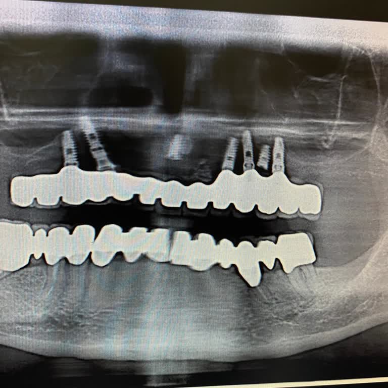 İstanbul Dental Center Şikayetimin Ciddiye Alınmaması Ve Hekimin Kötü Tavrı