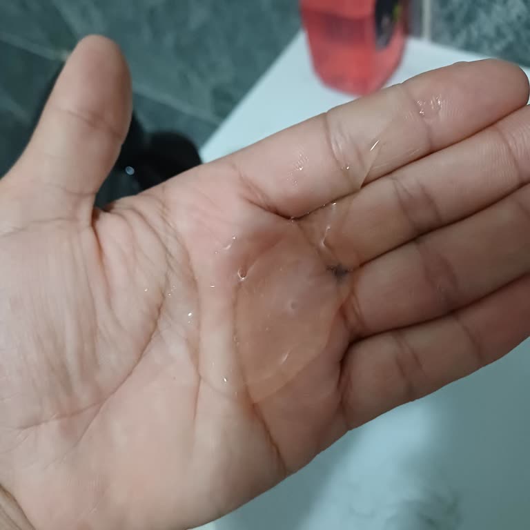 Yanıltıcı İddialarıyla Saç Dökülmesine Sebep Olan Simycare Şampuanı İçin İade Talebi