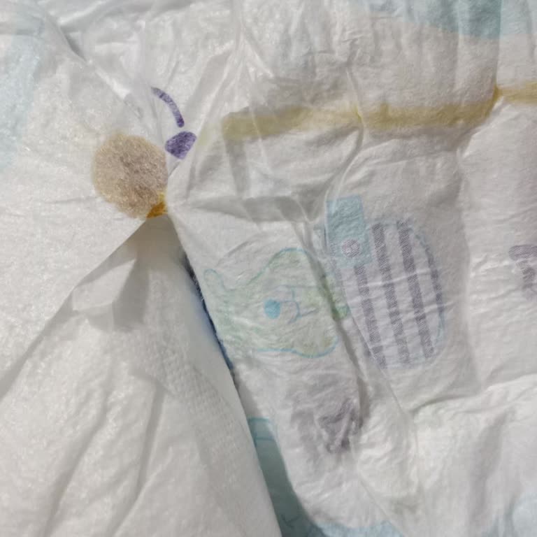 Molfix Bebek Bezinde Kahverengi Lekeler: Değişim Veya İade Beklentisi