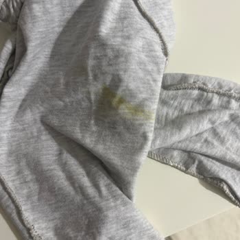 Prima Premium Care 6 Bebek Bezinde Yeni Form Sızıntı Problemi Ve İade Talebi