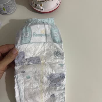 Prima Premium Care 6 Bebek Bezinde Yeni Form Sızıntı Problemi Ve İade Talebi
