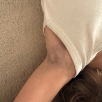 LCW Bebek Sweatshirt’te Renk Geçişi Ve Sağlık Endişesi