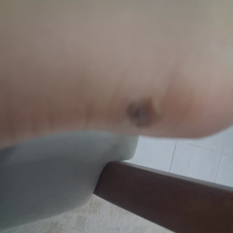 FLO Mağazasında Ayakkabı Topuk Ağrısı Sorunu Ve Değişim Reddi