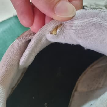 Lacoste Ayakkabısında Kısa Sürede Deformasyon Ve Mağaza İnceleme Sürecinde Çözüm Sunulmaması