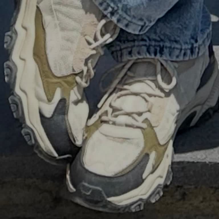Skechers Erkek Spor Ayakkabısının Erken Deformasyonu Ve Mağazanın Kullanıcı Hatası İddiası
