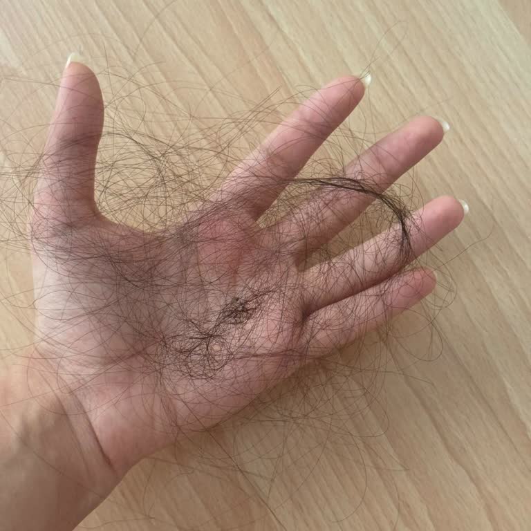 Elseve Şampuanı Kullanımından Sonra Şiddetli Kaşıntı Ve Saç Dökülmesi