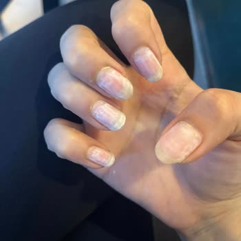 Babygirl Şubesinde Randevu Bekletilmesi, Hijyen Eksikliği Ve Tırnak Hasarı