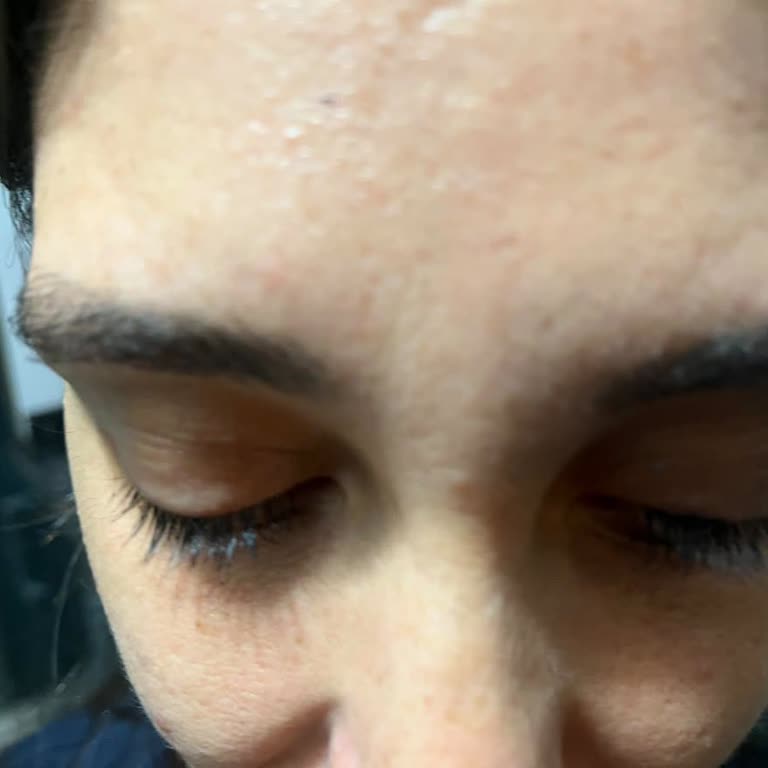Zey Beauty'de Kirpik Lifting İşlemi Başarısız, Ücret İadesi Ve Fatura Talebi