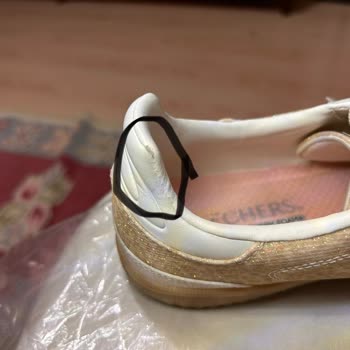 Altı Kez Kullanımda Deri Sıyrılan Skechers Ayakkabı Ayıplı Olarak Değerlendirilsin