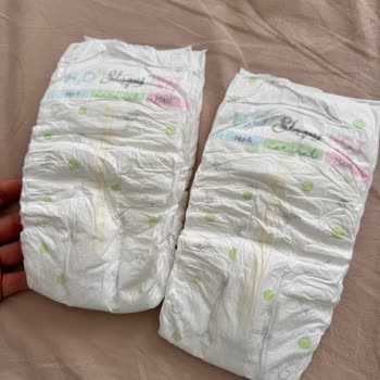 Sleepy Ultra Paketi Bebek Bezinde Şiddetli Koku Sorunu