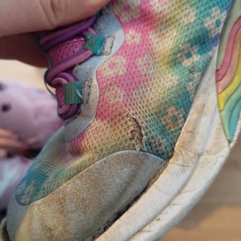 Kısa Sürede Deforme Olan Skechers Çocuk Ayakkabısı İçin İnceleme Talebi Açılamıyor