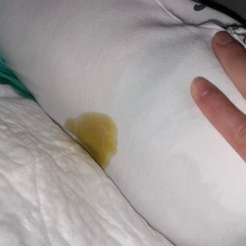 Prima Premium Care Bebek Bezinde Sürekli Sızdırma Ve İade Talebi