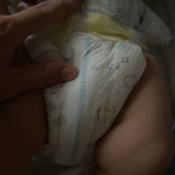 Prima Premium Care Bebek Bezinde Sürekli Sızdırma Ve İade Talebi