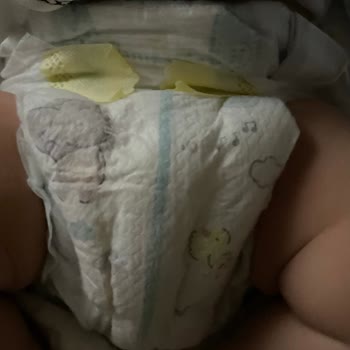 Prima Premium Care Bebek Bezinde Sürekli Sızdırma Ve İade Talebi