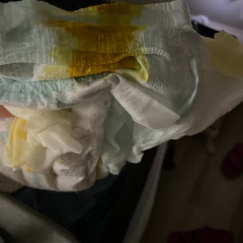 Prima Premium Care Bebek Bezinde Sürekli Sızdırma Ve İade Talebi