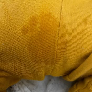Prima Premium Care Bebek Bezinde Tekrarlayan Sızıntı Sorunu