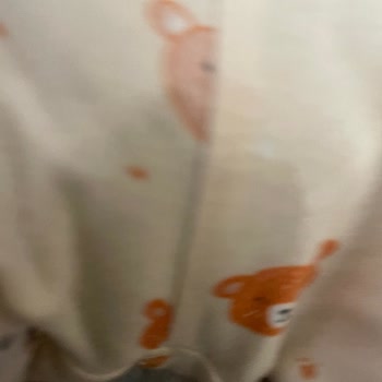 Prima Premium Care Bebek Bezinde Tekrarlayan Sızıntı Sorunu