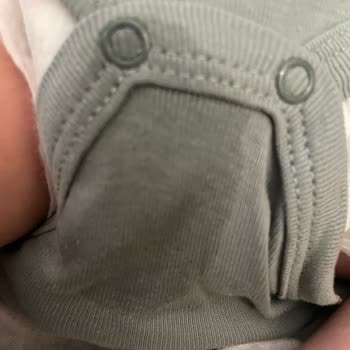Prima Premium Care Bebek Bezinde Tekrarlayan Sızıntı Sorunu
