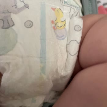 Prima Premium Care Bebek Bezinde Tekrarlayan Sızıntı Sorunu