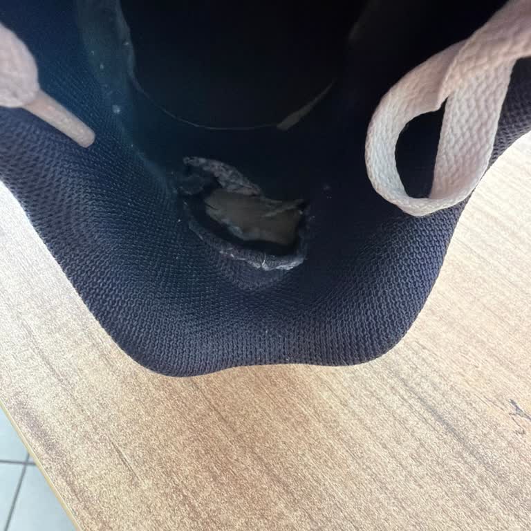 FLO Mağazasında 2 Yıllık Garantili Adidas Ayakkabının Topuk Yırtılması Ve Kullanıcı Hatası İddiası