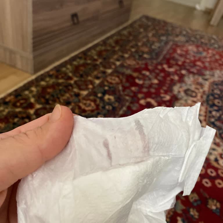 Pure Baby Bebek Bezlerinde Yapışkan Sorunu Ve Cilt Tahrişi Riski