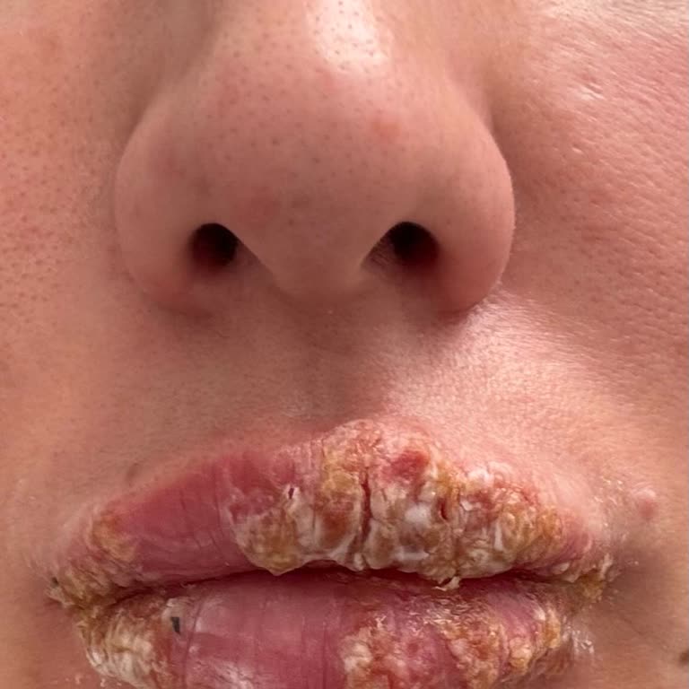 Myart Klinik Kusurlu Dudak Pigmentasyonu Ve İzinsiz Video Paylaşımı İade Talebi
