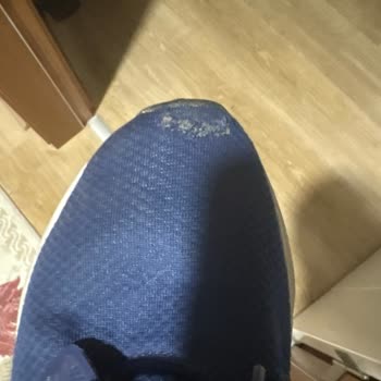 Adidas Mağazasında Ayakkabı Yırtılması Ve İade Reddi