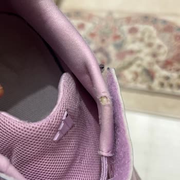 Adidas Çocuk Ayakkabısındaki Erken Yırtılma Ve FLO İade Reddi