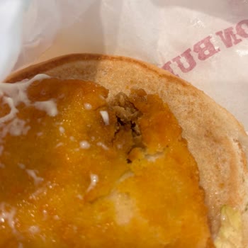 Yabancı Madde İçeren Burger Ve Hijyen Sorunu