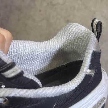 Skechers Ayakkabısının Kısa Sürede Deforme Olması Ve Değişim Talebimin Red Edilmesi