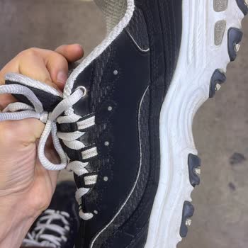 Skechers Ayakkabısının Kısa Sürede Deforme Olması Ve Değişim Talebimin Red Edilmesi