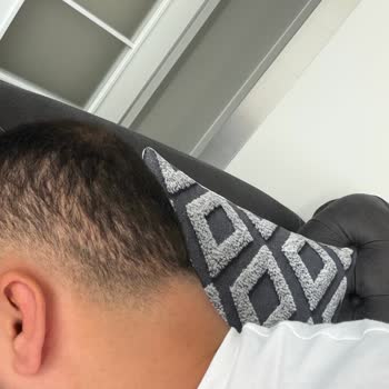 Gold City Hair Acıbadem Şubesinde Saç Ekimi Sonuçsuz Ve Ücret İstemi