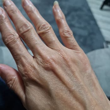 Garnier Vitamin C Glow Booster Cildimde Kuruluk Ve Koyu Lekeler Oluştu