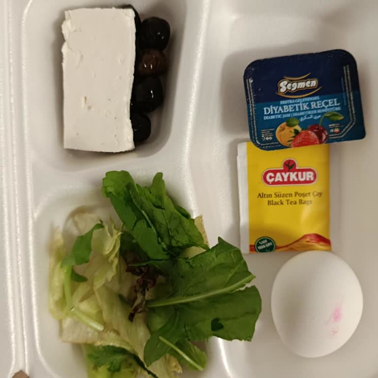 Bilkent Şehir Hastanesi Yemekhanesinde Çürük Salata Ve Yeşillik Sunumu Kabul Edilemez