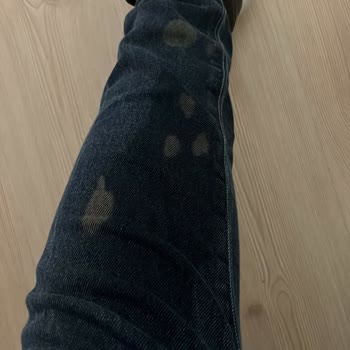 Açık Kapaklı Porçöz Nedeniyle Kot Pantolonum Mahvoldu Ve Tazmin Talebi