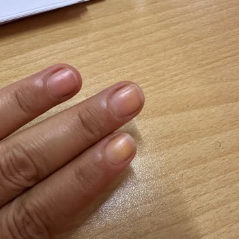 Pastel A*** S****** Oje Setinde Tırnak Sararması