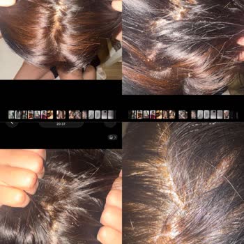 Rus Keratin Pendik & Yaz Nail Hause'de Saç Yanması ve Hasarı Nedeniyle İade Talebi